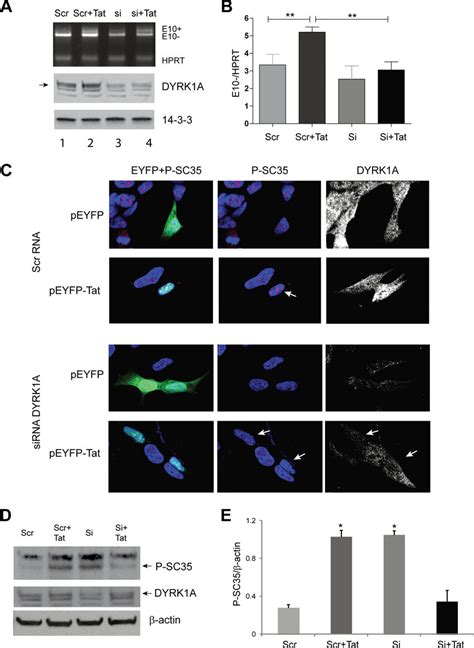 Silencing Dyrk A Inhibits Tat Mediated Increase In P Sc And Promotes