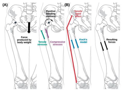 Bone Anatomy And Bending Stress