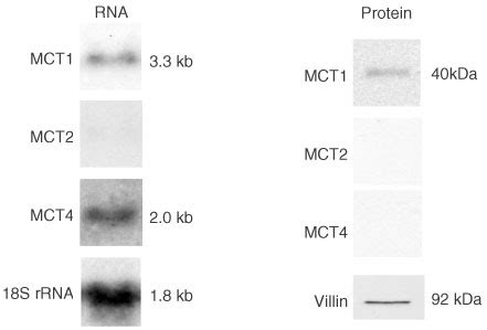 assessment   expression  mct  mct   colon carcinoma