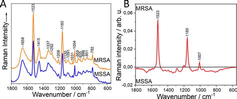 Comparison Of Different Label Free Raman Spectroscopy Approaches For