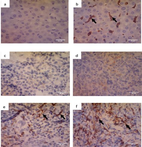 Immunohistochemistry Of M2 Macrophage Using Anti Cd163 Antibody Download Scientific Diagram