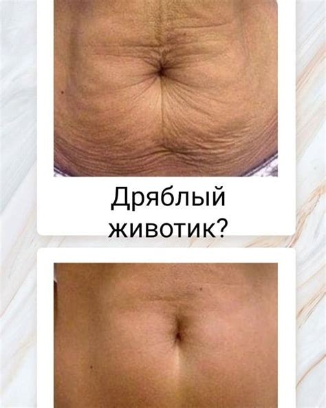 Ideal' аппаратная косметология - Home