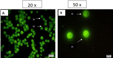 Fluorescent Micrographs Of Acridine Orange And Propidium Iodide