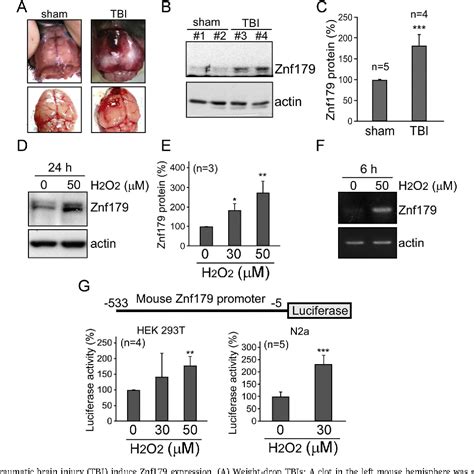 Figure 1 from Specificity protein 1-zinc finger protein 179 pathway is ...