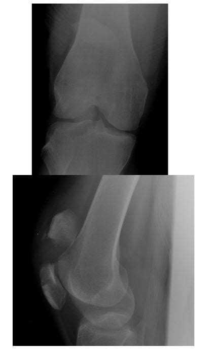 Knee — Ortho Teaching Files — Nuem Blog