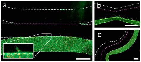 Micromachines Free Full Text Patterning Biological Gels For 3d Cell Culture Inside