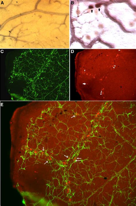 Immunohistochemistry In Retinal Wholemount Tissue A Tunel Brown Gs