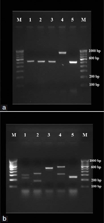 A Pcr Products From Standard Strains Of Candida Species Lanes