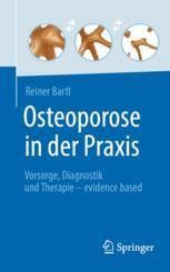 Osteoporose In Der Praxis Vorsorge Diagnostik Und Therapie Evidence