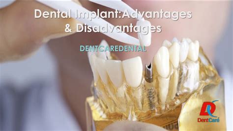 PPT Dental Implant Advantages And Disadvantages PowerPoint