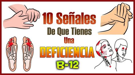 Cuáles Son Los Síntomas De La Falta De Vitamina B12 10 Señales