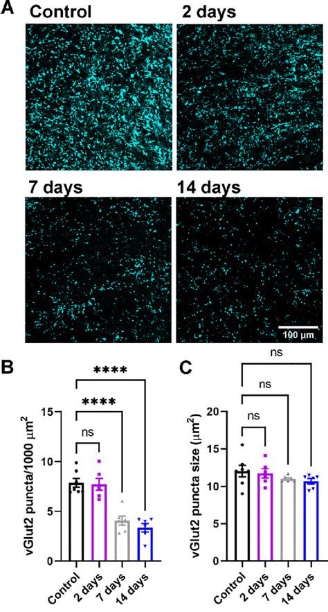 Loss Of Vglut2 Positive Rgc Terminals In The Dlgn Following