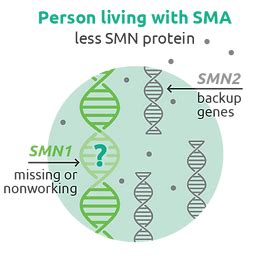 SMA | Victorkracht