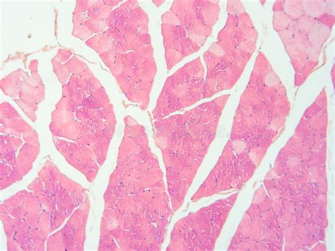 Tendon Histology Labeled