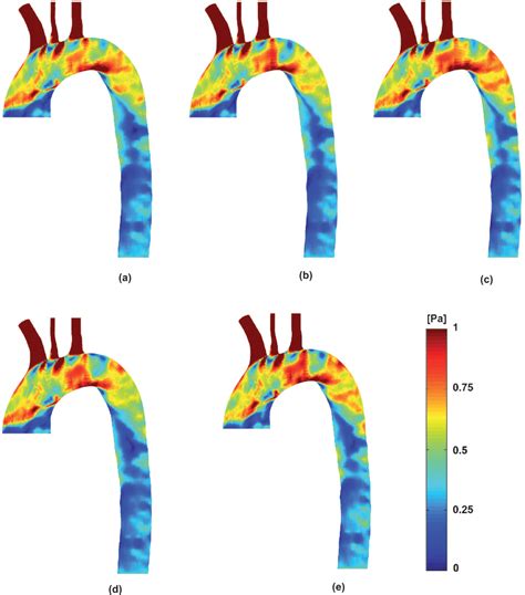 Figure From Wall Shear Stress In A Subject Specific Human Aorta