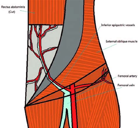 Inferior Epigastric Region Is