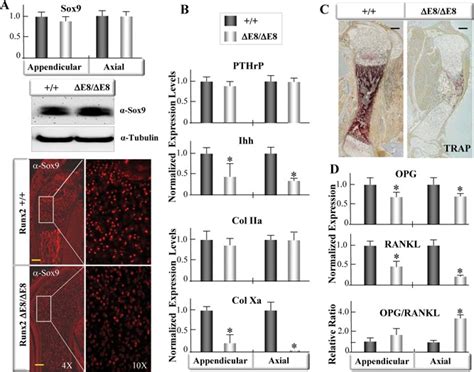 PTHrP Ihh Regulatory Loop And RANKL OPG Signaling Are Perturbed In