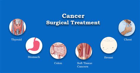 Cancer Surgical Treatment In Kochi Dr R Padmakumar Vps Lakeshore