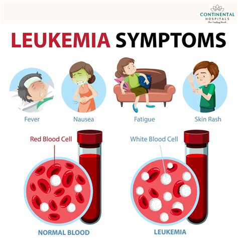 Symptoms Of Leukemia Recognizing Early Warning Signs