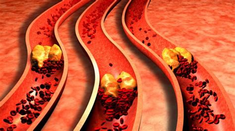 Potraviny Kter V M Pomohou Rychle Sn It Vysok Cholesterol