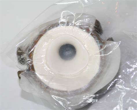 Scleral Shells New Zealand Prosthetic Eye Service