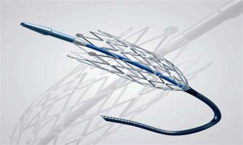 NITINOL WIRE- Shape Memory Alloys in Ahmedabad | smawiresindia.com