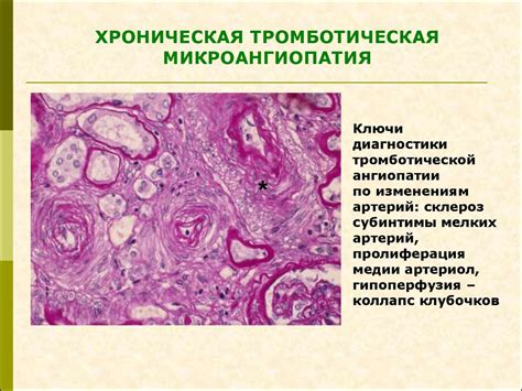 Мембрано-пролиферативный гломерулонефрит - презентация онлайн
