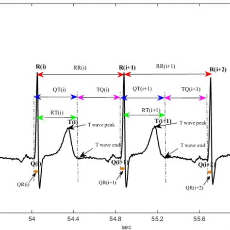 Schematic Representation Of Different Of Ecg Wave Intervals Rr