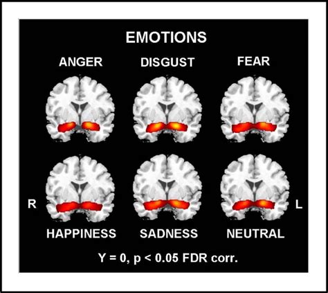 General And Specific Responsiveness Of The Amygdala During Explicit