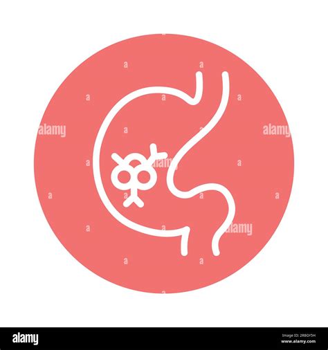 Stomach Cancer Vector Vectors Hi Res Stock Photography And Images Alamy