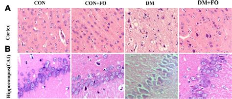 Morphological Changes In Cortical And Hippocampal Neurons A