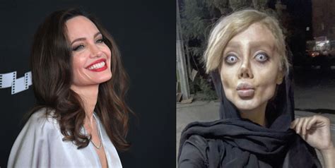 Woman Has Had 50 Surgeries To Look Like Angelina Jolie Iheart