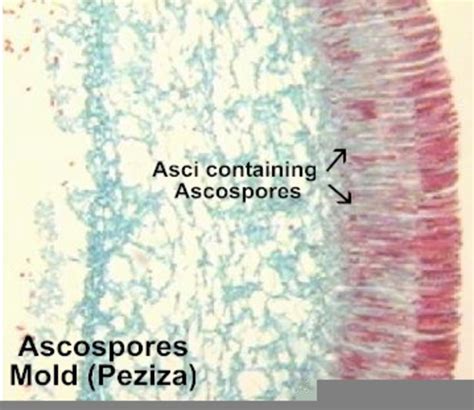 Peziza Under Microscope Labeled