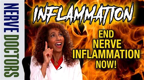 End Nerve Inflammation Now The Nerve Doctors Youtube