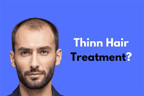 Thin Hair Treatment? - Toppik Hair Fiber in Pakistan