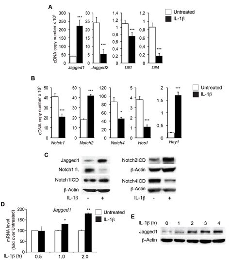 IL 1β modulates the expression of components of the Notch pathway in