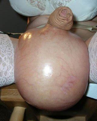 Extreme Bizarre Fetish Porn Pictures Xxx Photos Sex Images