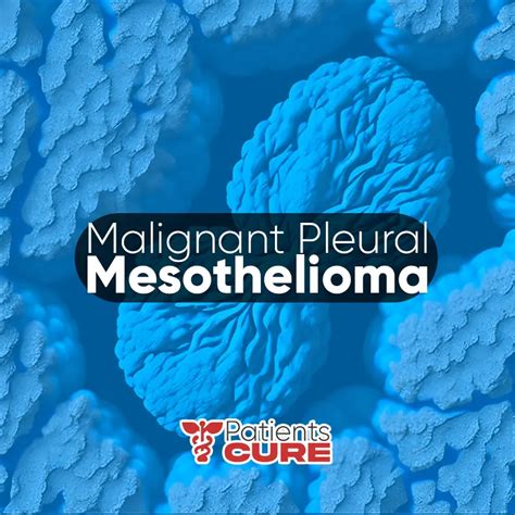 Malignant Pleural Mesothelioma Causes Symptoms And Treatment