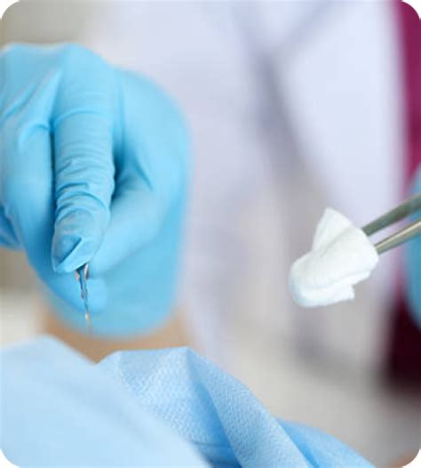 Cirugía de la fisura anal Dr Santiago Mera