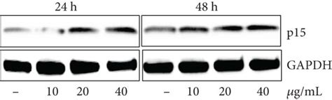 Mep Induces G1 Phase Arrest In Pca Cells A Percentage Of Cell