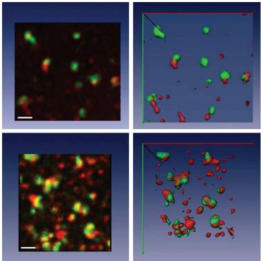 Analysis Of 3D Colocalization QuantaCell Image Analysis