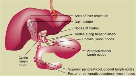 Difference Between Cholecystitis And Cholelithiasis Youtube