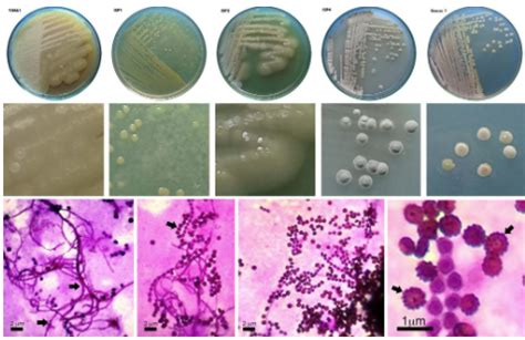 Isolation and screening antimicrobial activity of soil actinobacteria