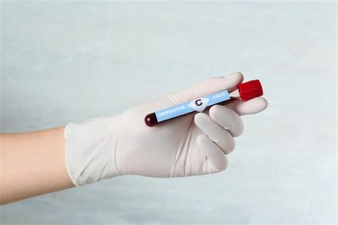 Cientista segurando tubo amostra de sangue e rótulo Teste de