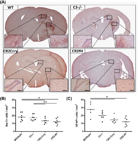 Complement Inhibition Reduces Microglia Macrophage Activation And