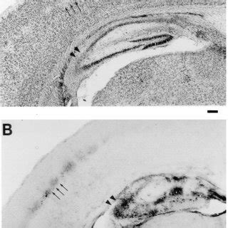 Representative photomicrographs through cortex and hippocampus ... 
