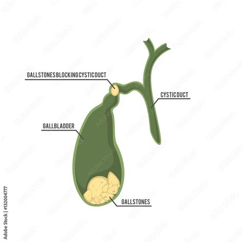 The Human Gallbladder