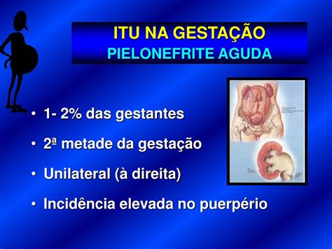 PPT Infecção do Trato Urinário na gestação PowerPoint Presentation