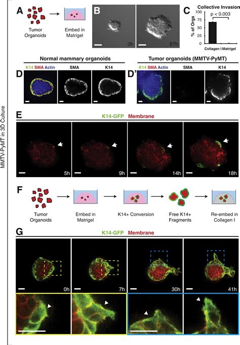 Collective Invasion In Breast Cancer Requires A Conserved Basal