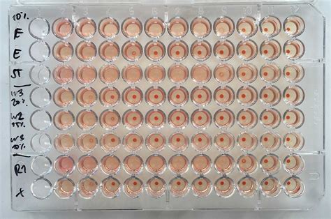 Hemagglutination Assay Wikiwand